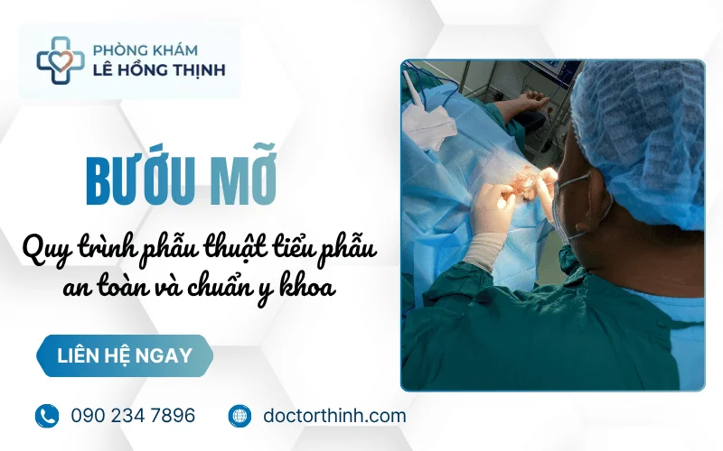 Bướu mỡ