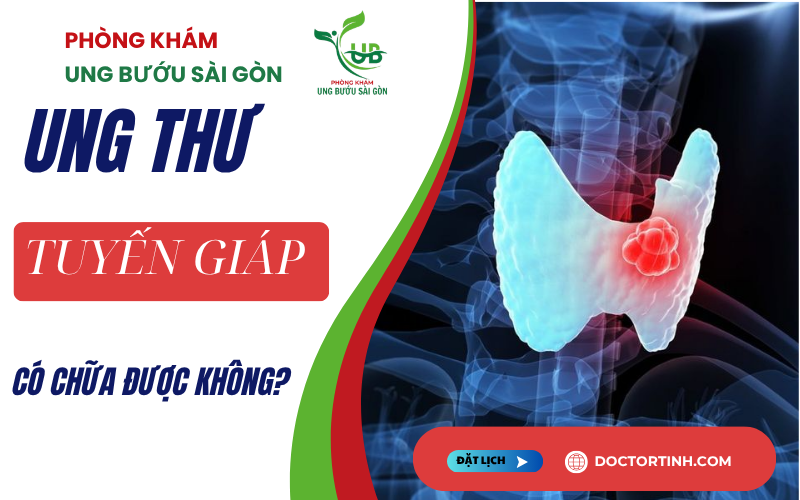 Ung thư tuyến giáp có nguy hiểm không? Khả năng chữa khỏi và tiên lượng bệnh