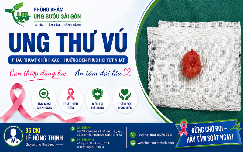 Phẫu thuật ung thư tuyến vú – Cơ hội điều trị hiệu quả khi phát hiện bệnh sớm