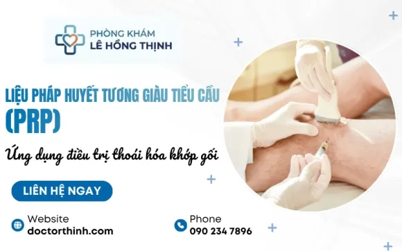 Ứng dụng liệu pháp huyết tương giàu tiểu cầu (PRP) điều trị thoái hóa khớp gối
