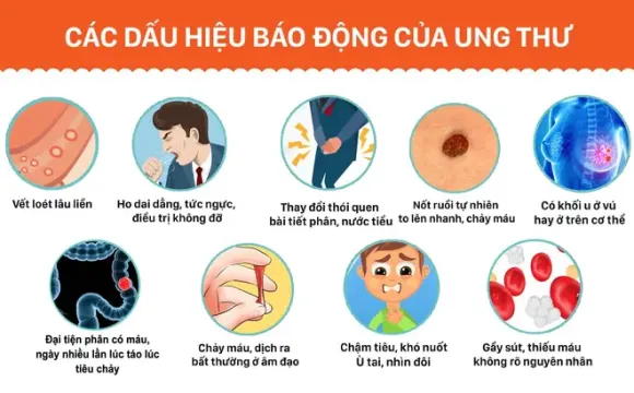 Tình hình bệnh Ung thư tại Việt Nam