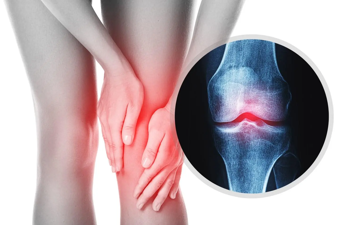 Bảo Vệ Xương Khớp: Bí Quyết Vàng Để Sống Khỏe Mạnh, Dẻo Dai