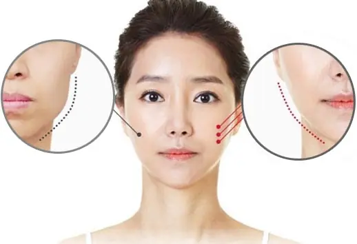 BÁC SĨ CHUYÊN KHOA 1 - LÊ HỒNG THỊNH